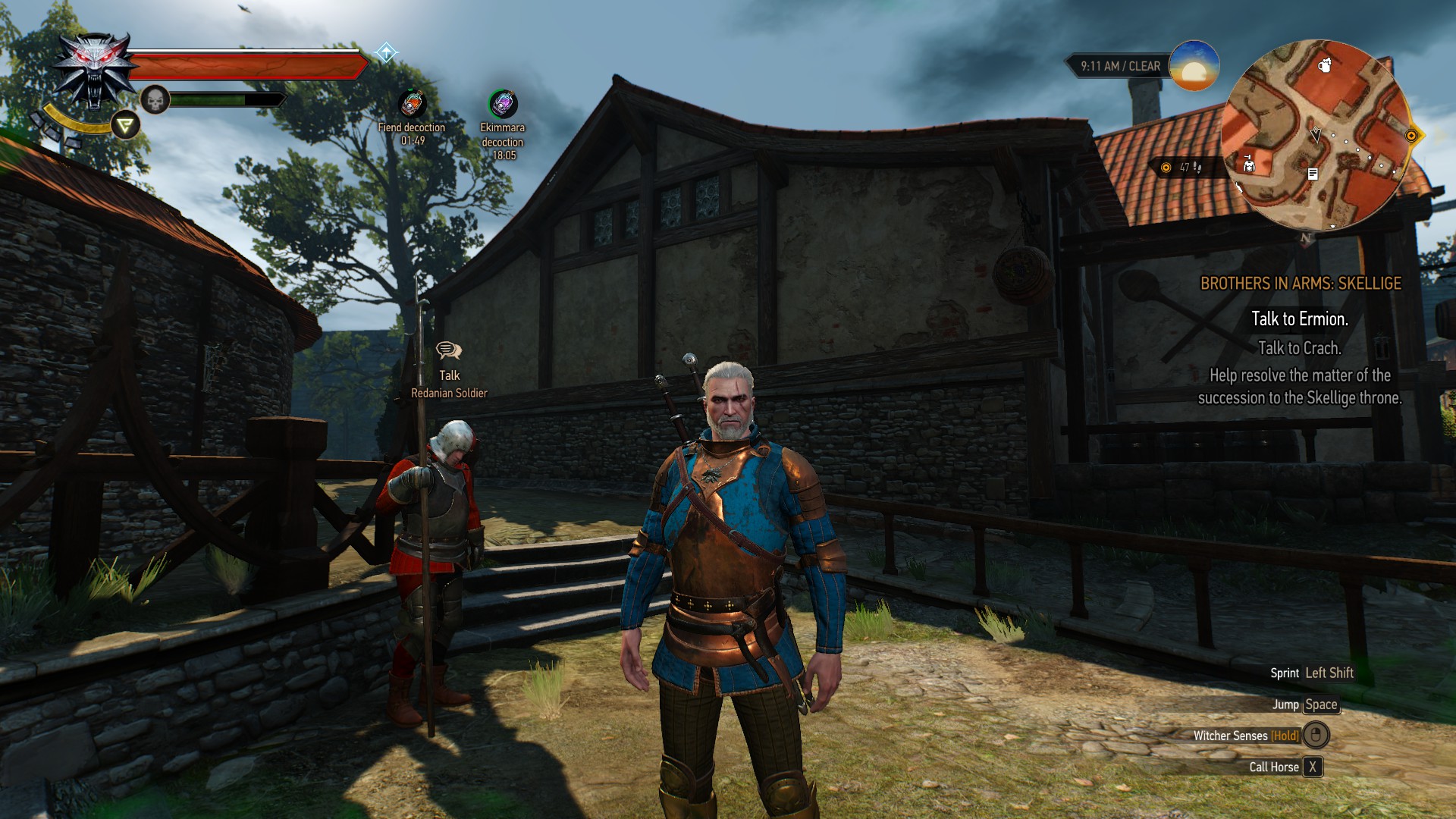 Featured image of post Zireael Armor Witcher 3 Q a boards community contribute games what s new